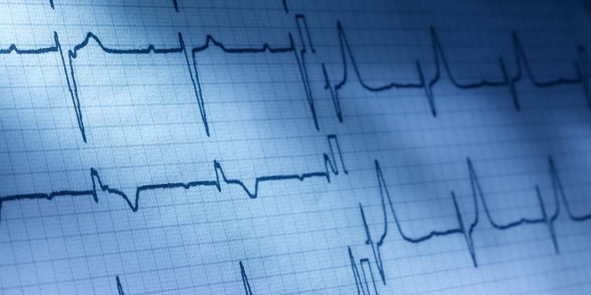 ekg cihazi - kalp cihazı - Medisan Sağlık Sistemleri