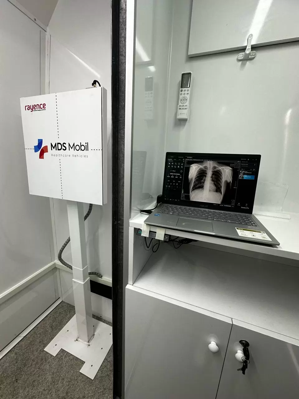 Medisan Sağlık - Röntgen Makinesi Çeşitleri ve Kullanım Alanları